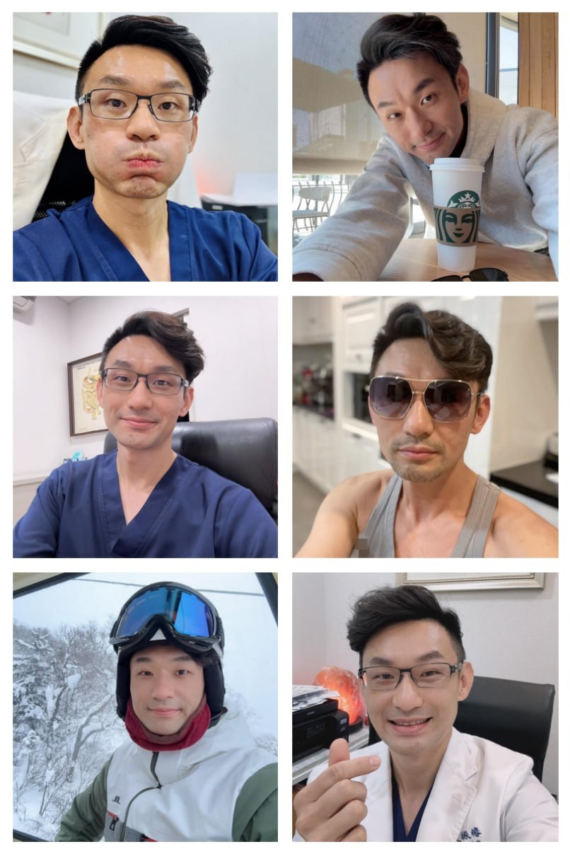 XR266 图片4533张 视频50个 台湾 自拍 生活日常 医生 工作照 上过小综艺 生活场景丰富 海边 美食 旅游 风景 630粉丝   曝光度低